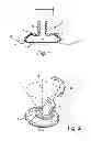 Fig. 02 - Forehead-contacting device for a breathing mask and method for making the same