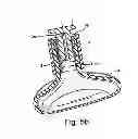 Fig. 05 - Forehead-contacting device for a breathing mask and method for making the same