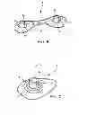 Fig. 06 - Forehead-contacting device for a breathing mask and method for making the same