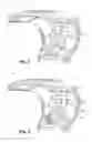 Fig. 03 - SECURING TO A PNEUMATIC TIRE
