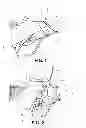 Fig. 02 - SAFETY DEVICE FOR SADDLES