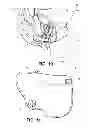 Fig. 07 - SAFETY DEVICE FOR SADDLES