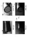 Fig. 08 - Concentric cutting assembly, concentric cutting system, and net penetration method