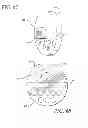 Fig. 37 - Animal toy with squeaker