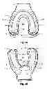Fig. 06 - Breathing assist device