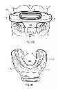 Fig. 08 - Breathing assist device