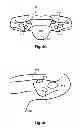 Fig. 09 - Breathing assist device
