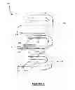 Fig. 03 - Self-titratable mandibular repositioning device