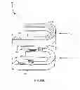 Fig. 05 - Self-titratable mandibular repositioning device