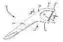 Fig. 01 - MULTIPLE STRAND DENTAL FLOSSER