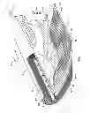 Fig. 02 - Spiral wound filtration module