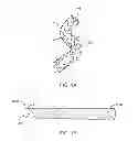 Fig. 02 - Method of Manufacturing a Stent-Graft Prosthesis With Two Layers of Expanded Polytetrafluoroethylene