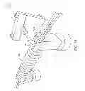 Fig. 06 - Method of Manufacturing a Stent-Graft Prosthesis With Two Layers of Expanded Polytetrafluoroethylene