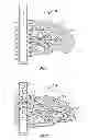 Fig. 02 - PROPPANT PILLAR PLACEMENT IN A FRACTURE WITH HIGH SOLID CONTENT FLUID