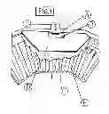 Fig. 02 - Acoustic Enhancement Balancer