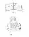 Fig. 02 - Disc brake pad mounting and retention system and method