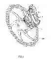 Fig. 02 - Mechanical disk brake caliper assembly