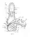 Fig. 02 - Musical instrument case with protective boot