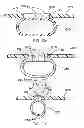 Fig. 19 - Packaging Material and Method for Microwave and Steam Cooking of Food Products