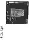 Fig. 11 - MULTILAYER ARTICLE AND METHOD FOR MAKING A MULTILAYER ARTICLE, BLANK, AND INSULATING CUP