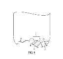 Fig. 09 - Flexible panel to offset pressure differential