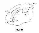 Fig. 08 - Self-energized seal or centralizer and associated setting and retraction mechanism