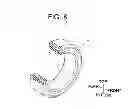 Fig. 09 - Vibration control structure for steering wheel