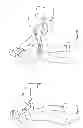 Fig. 12 - Shovel Attachment