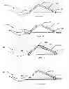 Fig. 15 - Shovel Attachment
