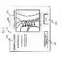 Fig. 04 - MAGNETIC RESONANCE IMAGING APPARATUS AND IMAGING POSITION SETTING ASSISSTING METHOD