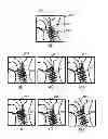 Fig. 08 - MAGNETIC RESONANCE IMAGING APPARATUS AND IMAGING POSITION SETTING ASSISSTING METHOD