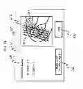 Fig. 17 - MAGNETIC RESONANCE IMAGING APPARATUS AND IMAGING POSITION SETTING ASSISSTING METHOD