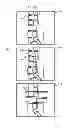 Fig. 23 - MAGNETIC RESONANCE IMAGING APPARATUS AND IMAGING POSITION SETTING ASSISSTING METHOD