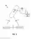 Fig. 04 - Capacitive sensor device