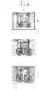 Fig. 09 - Image processing device, image processing method and program