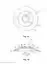 Fig. 02 - Means for controlling the progression of myopia