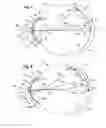 Fig. 06 - Means for controlling the progression of myopia