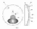 Fig. 04 - Refractive-Diffractive Multifocal Lens