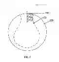 Fig. 08 - Refractive-Diffractive Multifocal Lens