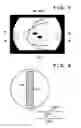 Fig. 07 - Ophthalmic imaging apparatus, control method for ophtalmic imaging apparatus, and storage medium