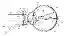 Fig. 01 - Myopia control means