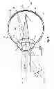 Fig. 03 - Myopia control means