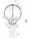 Fig. 05 - Myopia control means