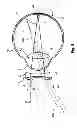 Fig. 06 - Myopia control means