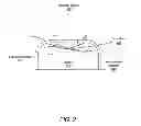 Fig. 03 - Graphite backscattered electron shield for use in an X-ray tube