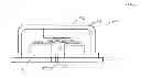 Fig. 01 - APPARATUS TO PREVENT EXCESS MOVEMENT OF MEMS COMPONENTS