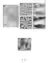 Fig. 08 - Methods for rapid distinction between debris and growing cells