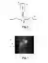 Fig. 03 - Respiratory motion determination apparatus