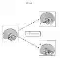Fig. 08 - Magnetic resonance imaging apparatus and method of acquiring functional image