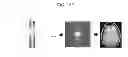 Fig. 19 - Magnetic resonance imaging apparatus and method of acquiring functional image